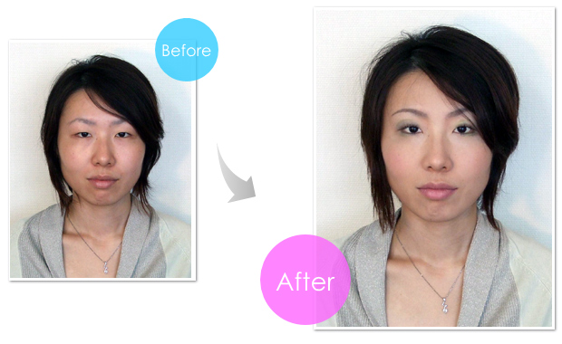 img-before-after-101